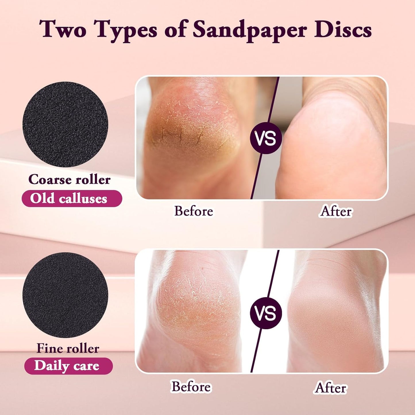 Removedor de callos eléctrico para pies, velocidad ajustable (0-600 rpm), exfoliante con 60 discos de lija, herramienta de pedicura para hombres y mujeres, color rosa