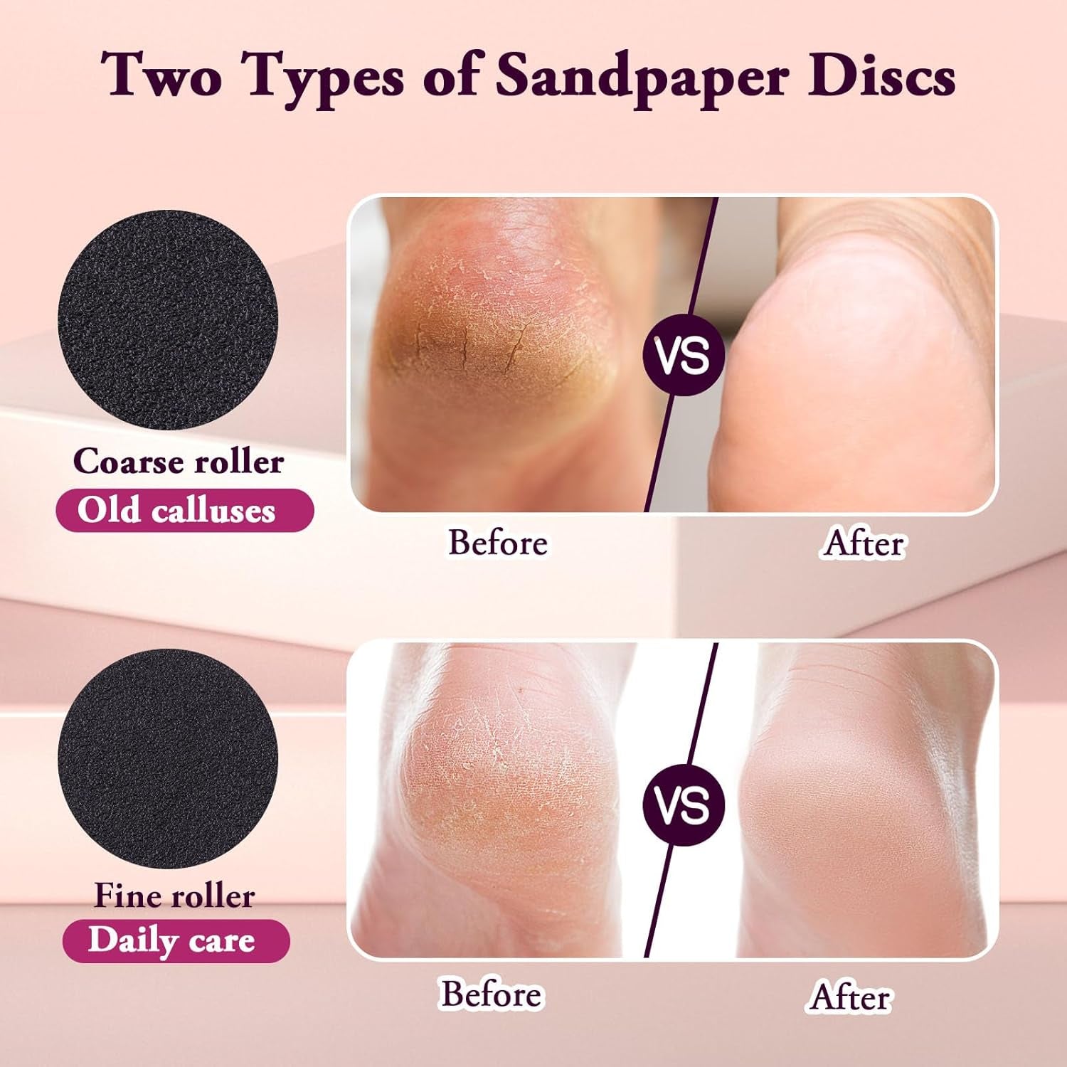 Removedor de callos eléctrico para pies, velocidad ajustable (0-600 rpm), exfoliante con 60 discos de lija, herramienta de pedicura para hombres y mujeres, color rosa